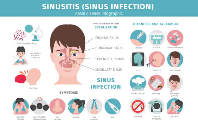 Signs And Symptoms Of Sinus Infection | Pathkind