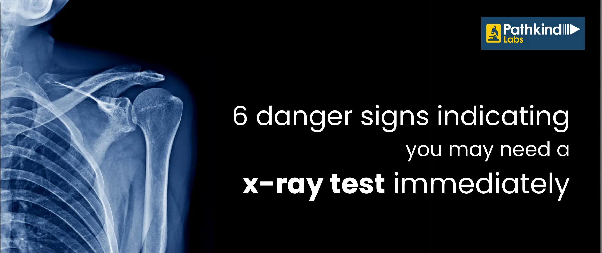  6 Danger Signs Indicating You May Need an X-ray Test Immediately