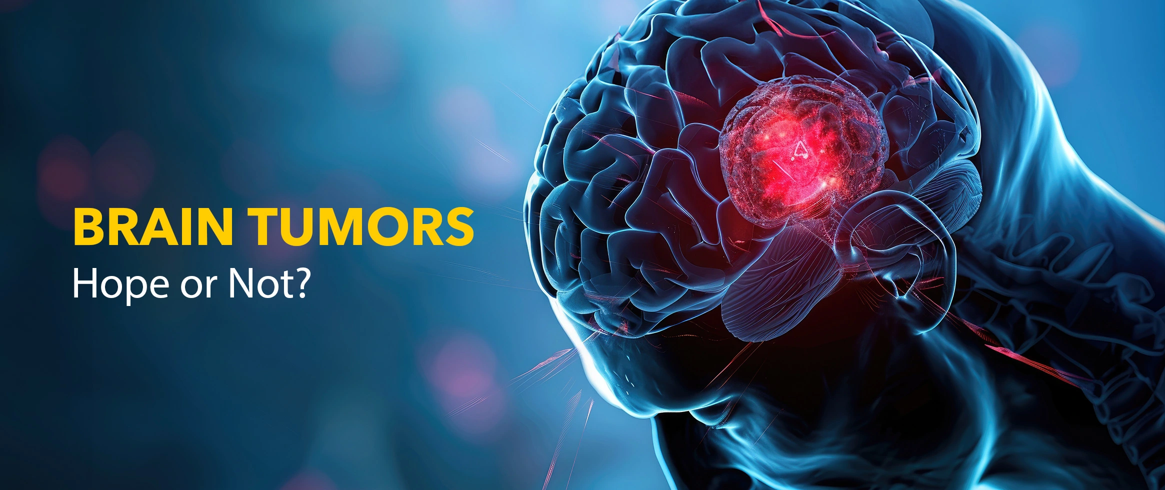 Brain Tumors