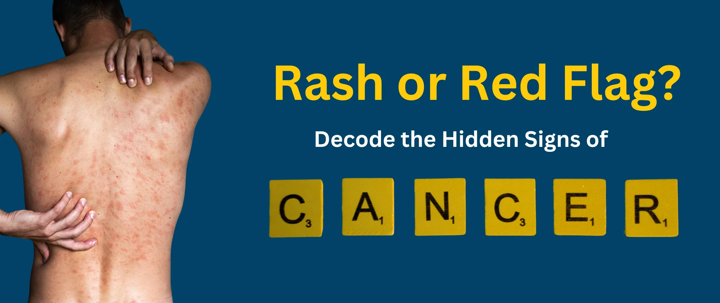 skin rash sign of cancer