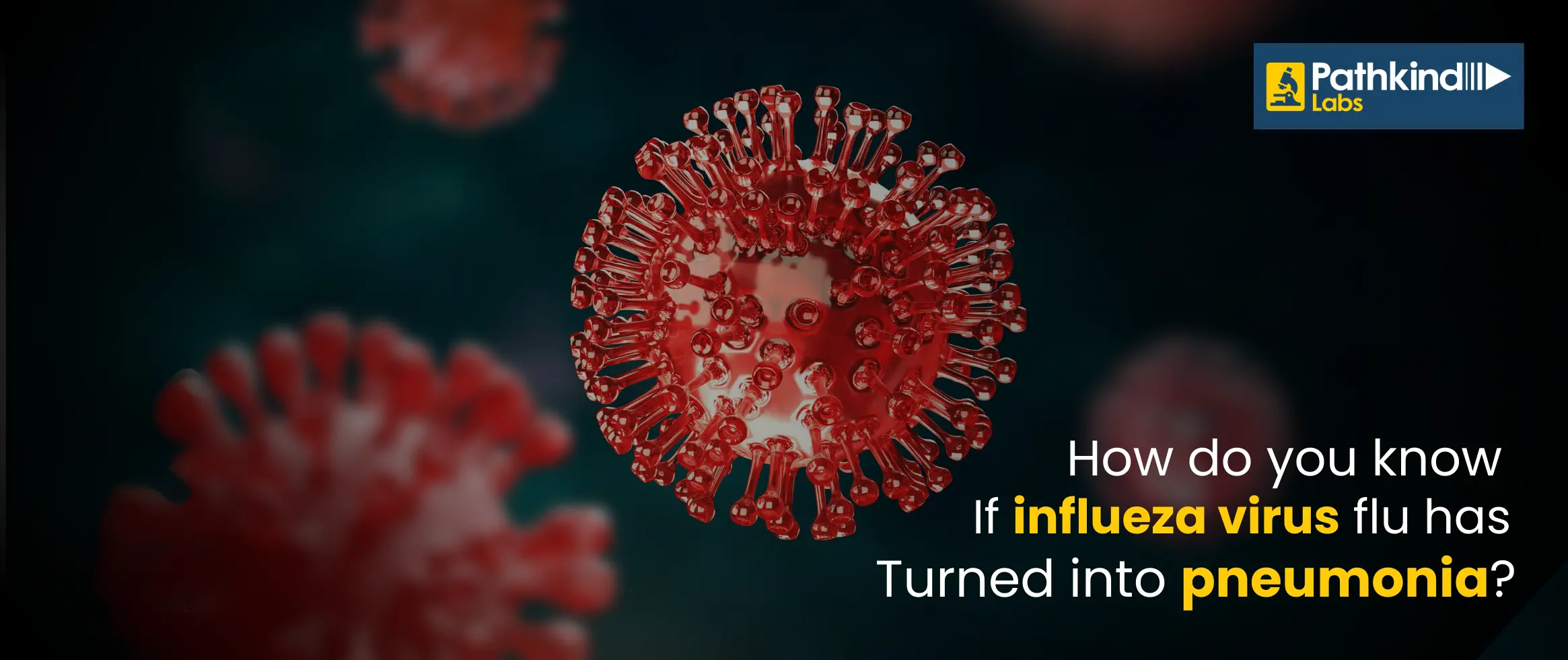  How do you Know if the Influenza Virus has Turned into Pneumonia?