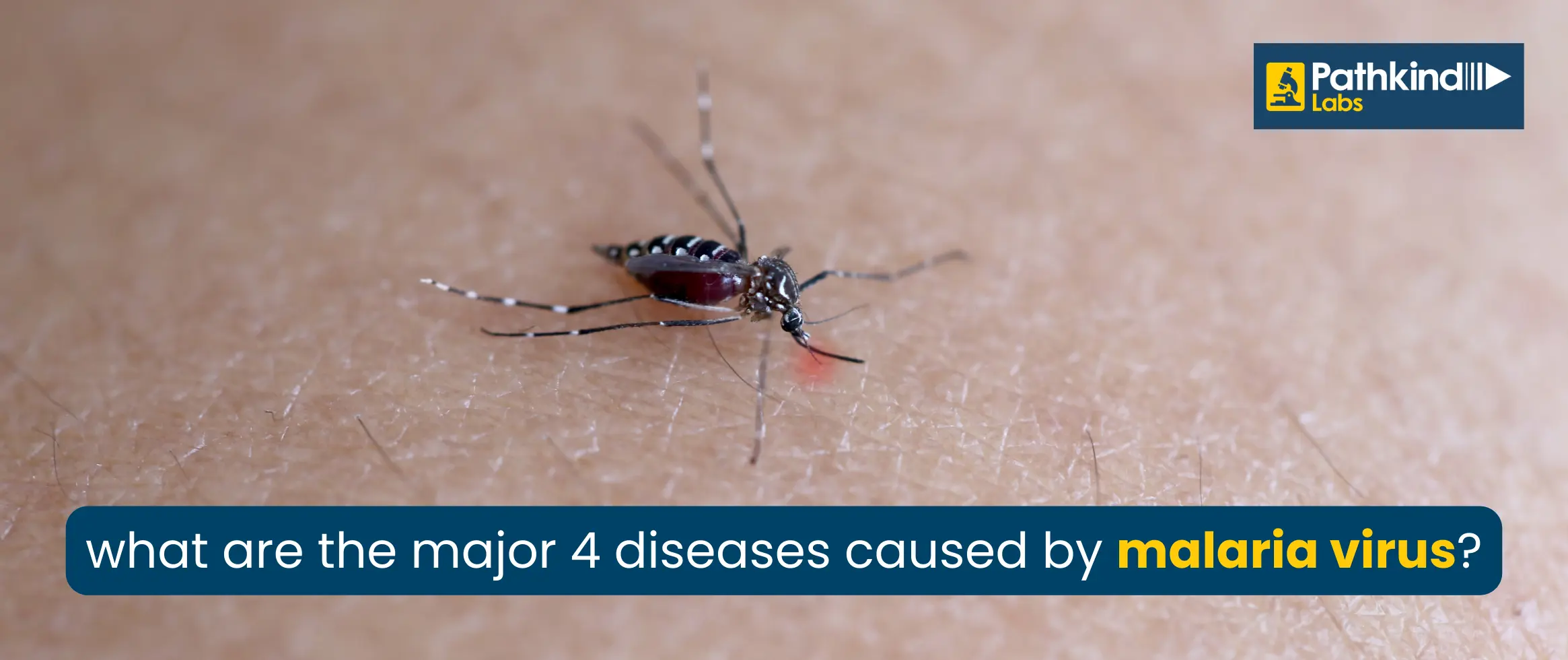  What are the Major 4 Diseases Caused by the Malaria Virus?